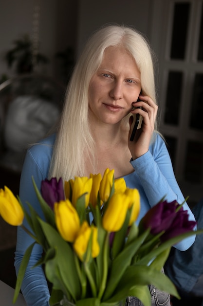 Mujer joven con albinismo y flores de tulipán.