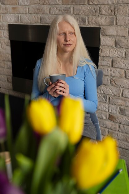 Mujer joven con albinismo y flores de tulipán.