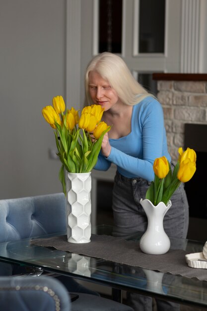 Foto gratuita mujer joven con albinismo y flores de tulipán.