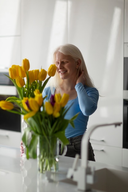 Mujer joven con albinismo y flores de tulipán.