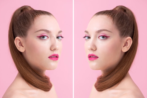 Mujer joven antes y después de la vista lateral de la rinoplastia
