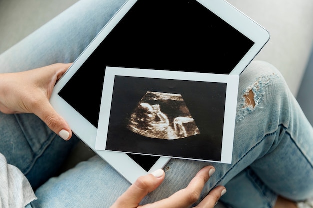 Mujer joven con ecografía y tablet