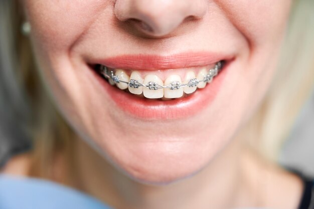 Mujer joven sonriente con frenos en los dientes