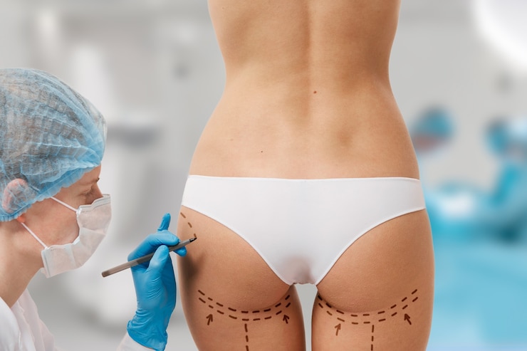 Foto gratuito mujer marcada para cirugía estética