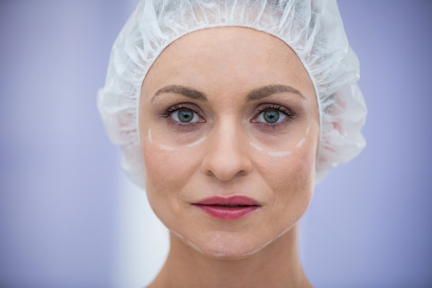 Mujer con marcas para tratamiento cosmético con gorro quirúrgico