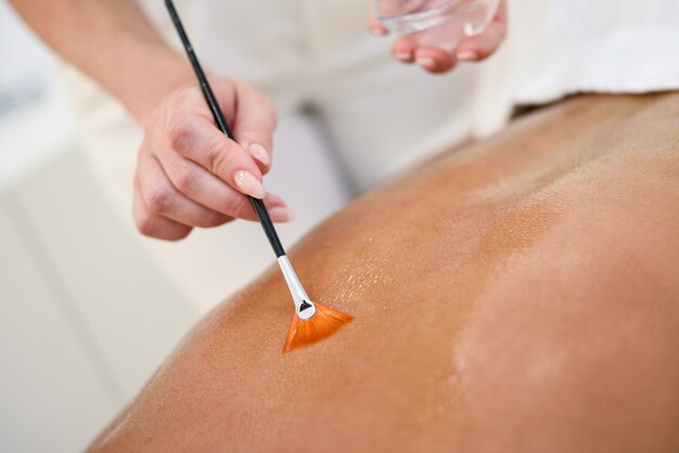 Mujer que recibe tratamiento de masaje de espalda con cepillo de aceite