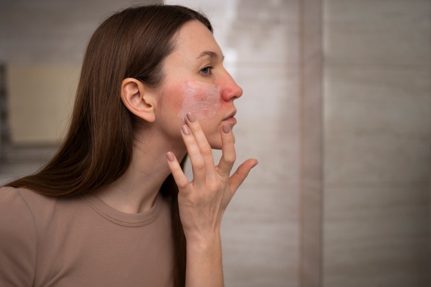 Mujer que usa humectante para ayudar con la condición de la piel con rosácea