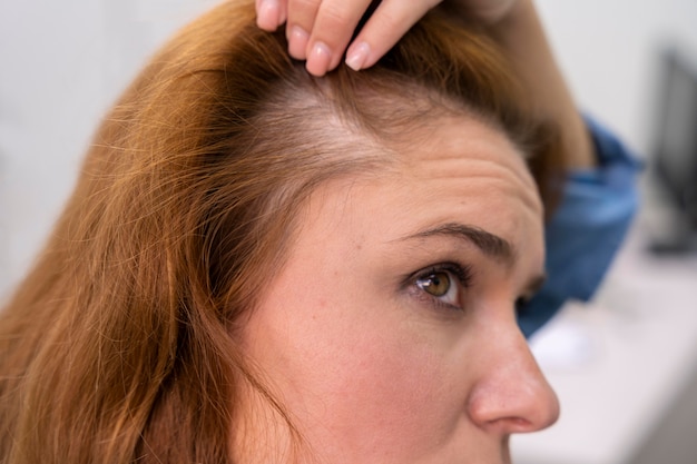 Foto gratuita mujer recibiendo un tratamiento de pérdida de cabello en una clínica