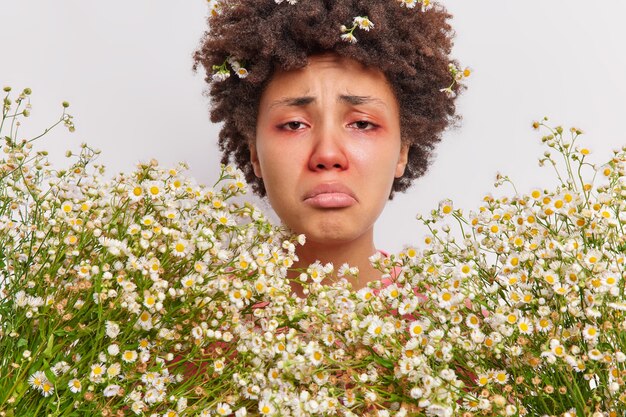 mujer rodeada de flores de manzanilla tiene los ojos rojos hinchados y la nariz triste sufre de alergia estacional al polen necesita la consulta de un inmunólogo