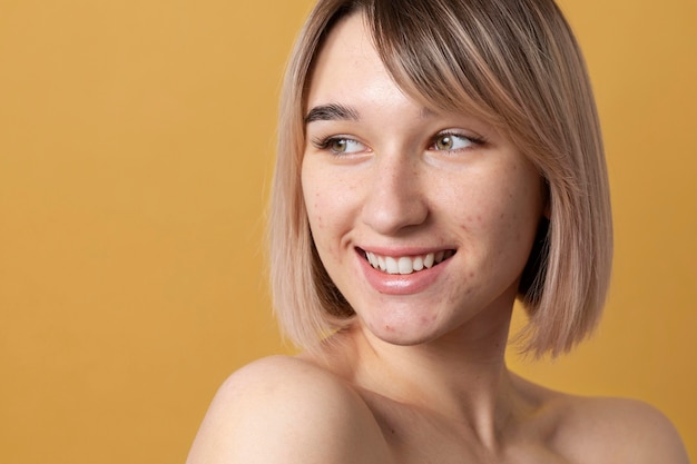 Mujer sonriente de tiro medio con acné