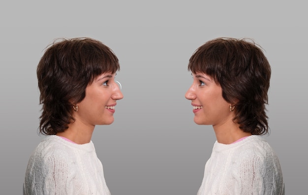 Mujer sonriente de vista lateral antes y después de la rinoplastia