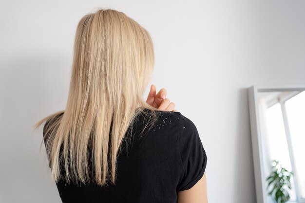 Mujer de tiro medio con cabello rubio y caspa.