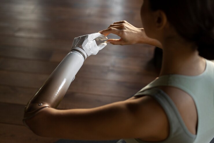 Foto gratuito mujer de vista lateral con brazo protésico