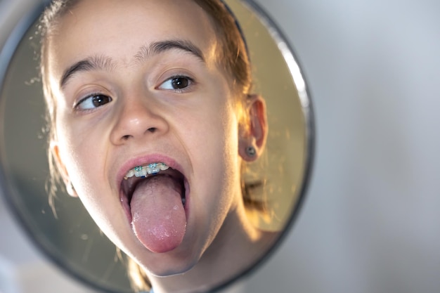 Foto gratuita niña caucásica con aparatos dentales mirándose en el espejo