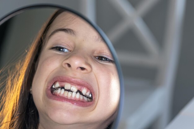 Niña preadolescente caucásica con aparatos ortopédicos en los dientes mirando al espejo