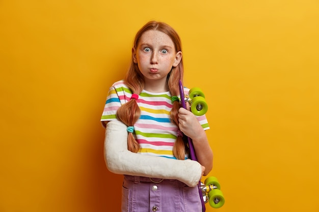 Niños, pasatiempo, concepto de pasatiempo. Chica pelirroja sopla las mejillas y mira fijamente, tiene poses de piel pecosa con ropa de patineta fundida en el brazo roto aislado en la pared amarilla. Patineta desafortunada