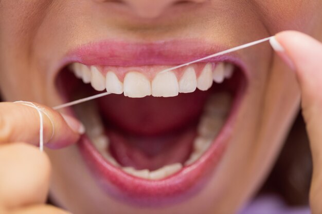 Paciente con hilo dental sus dientes