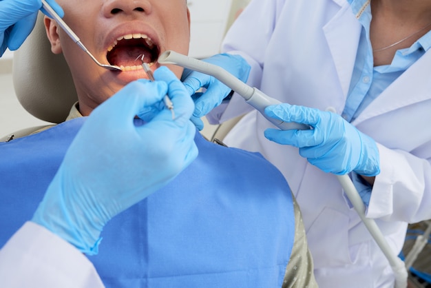 Paciente masculino recortado con la boca abierta en el examen de los dientes en la odontología