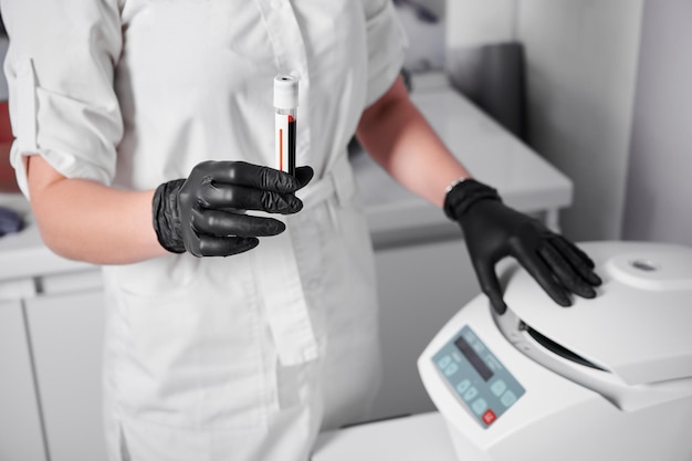 Foto gratuita preparación de sangre para inyecciones cosmetólogo pone tubo de sangre en centrífuga