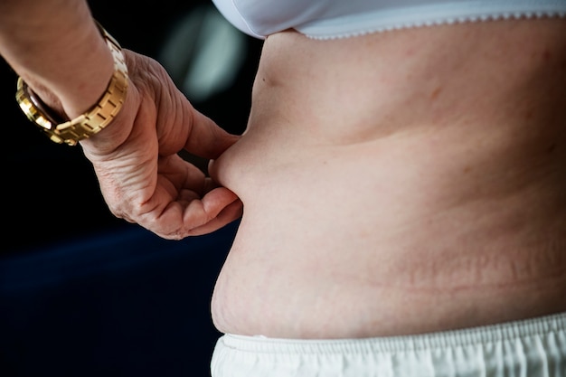 Primer plano de anciana obesa