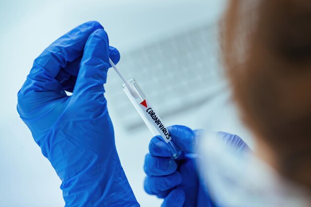 Primer plano de un experto en atención médica que usa una muestra de prueba mientras analiza el coronavirus en el laboratorio