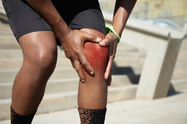 Foto gratuita primer plano de un joven con lesión en la rodilla