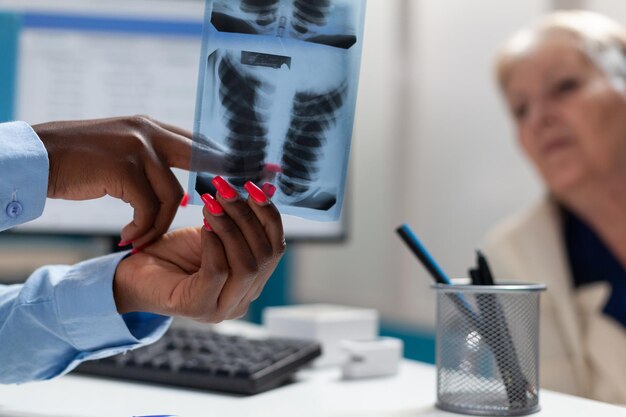 Primer plano de un médico terapeuta con radiografía de los pulmones que explica la experiencia de la enfermedad a una mujer discapacitada mayor enferma en silla de ruedas durante la consulta médica en la oficina del hospital. Concepto de medicina