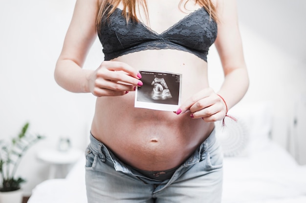 Primer plano de una mujer embarazada con foto de ultrasonido frente a su vientre
