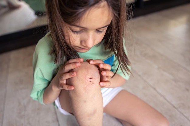 Foto gratuita el primer plano de una niña sosteniendo su rodilla herida magullada con las manos