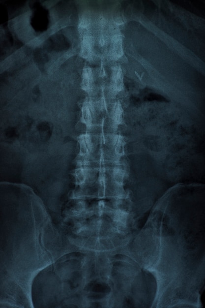 Rayos x de la columna vertebral