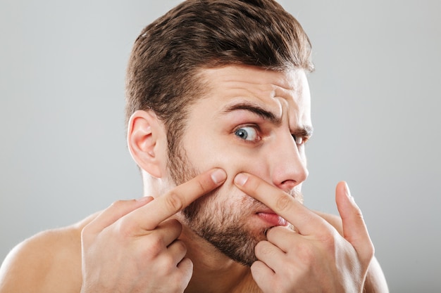 Foto gratuita retrato de un hombre apretando espinillas de cerca