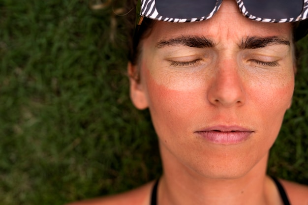 Foto gratuita retrato de mujer adulta con piel quemada por el sol