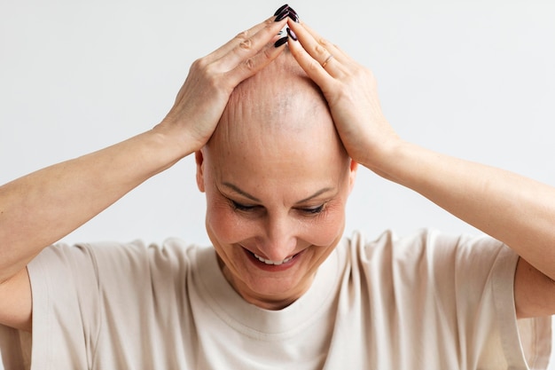 Retrato de mujer con cáncer de piel