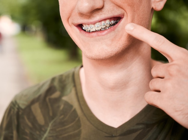 Retrato recortado de un joven sonriendo y demostrando sus dientes con aparatos ortopédicos