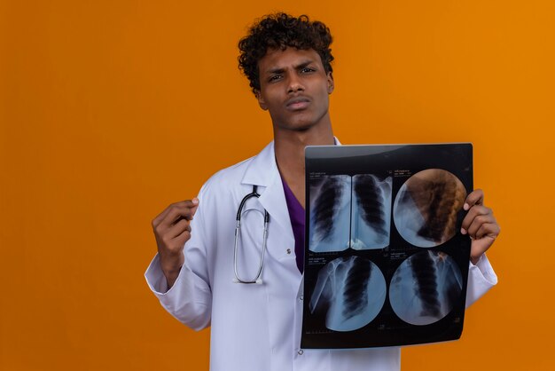 Un serio joven guapo médico de piel oscura con pelo rizado vistiendo bata blanca con estetoscopio mostrando informe de rayos x