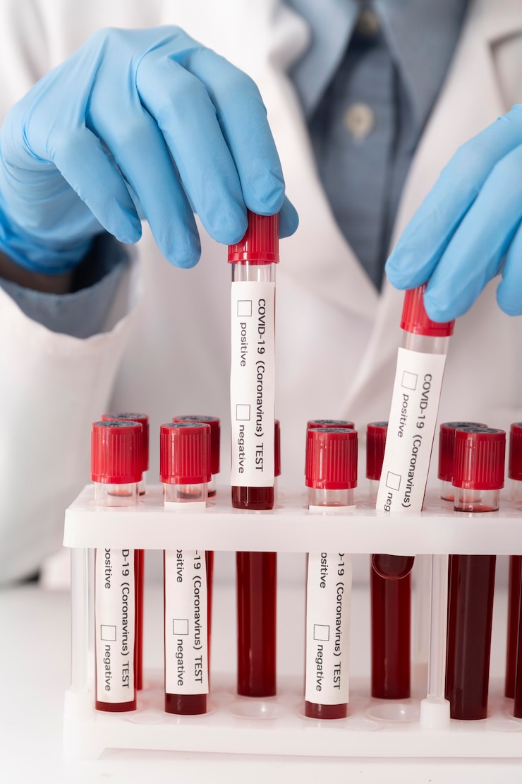 Foto gratuito surtido de muestras de sangre de coronavirus en el laboratorio