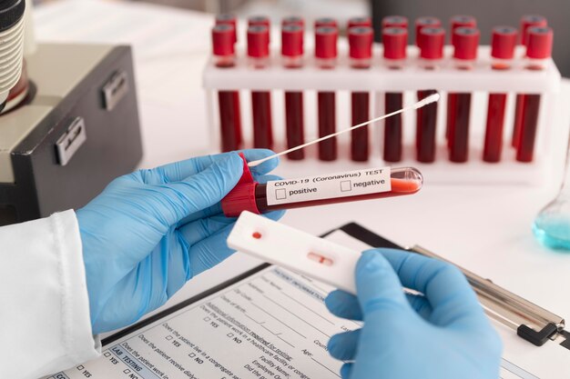 Surtido de pruebas de coronavirus en laboratorio