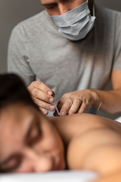 Terapeuta de primer plano haciendo acupuntura