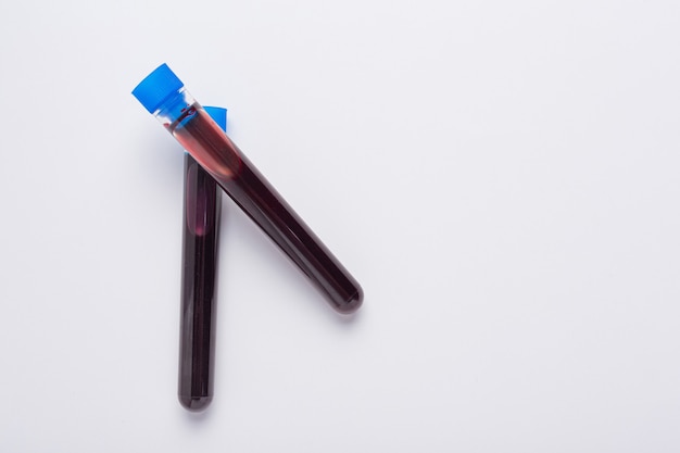 Tubo de ensayo con muestra de sangre para prueba COVID-19