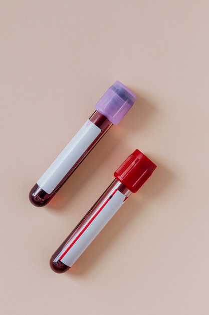 Foto gratuita tubos de ensayo de sangre en un beige