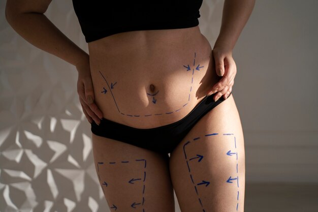 Vista frontal del cuerpo de la mujer con rastros de marcador.
