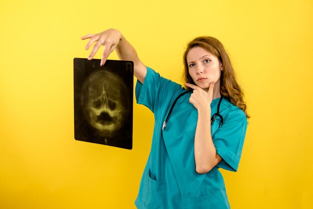 Vista frontal doctora sosteniendo radiografía en espacio amarillo