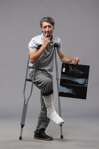 Vista frontal de un hombre joven con un pie roto con muletas y sosteniendo su radiografía en el escritorio gris, el dolor deshabilita el pie roto del accidente.