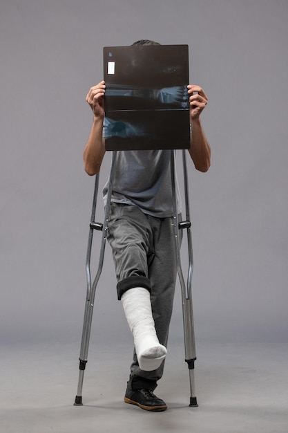 Vista frontal de un hombre joven con un pie roto con muletas y sosteniendo su radiografía en la pared gris deshabilitar el pie de dolor de accidente roto por giro