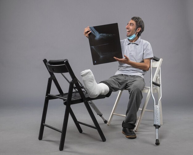 Vista frontal de un hombre joven sentado con un pie roto y sosteniendo una radiografía en el escritorio gris, dolor de torsión, pierna rota, accidente masculino