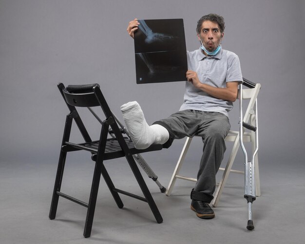 Vista frontal del hombre joven sentado con el pie roto y sosteniendo la radiografía de la misma en el escritorio gris medicina giro dolor masculino pierna rota