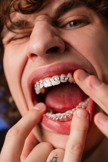 Vista frontal hombre posando con gemas dentales