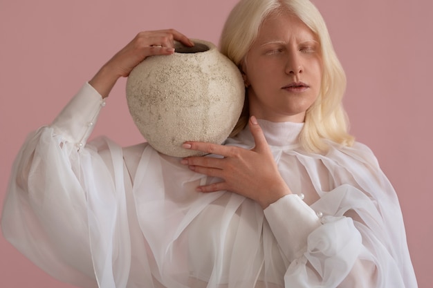 Foto gratuita vista frontal mujer con albinismo posando en estudio