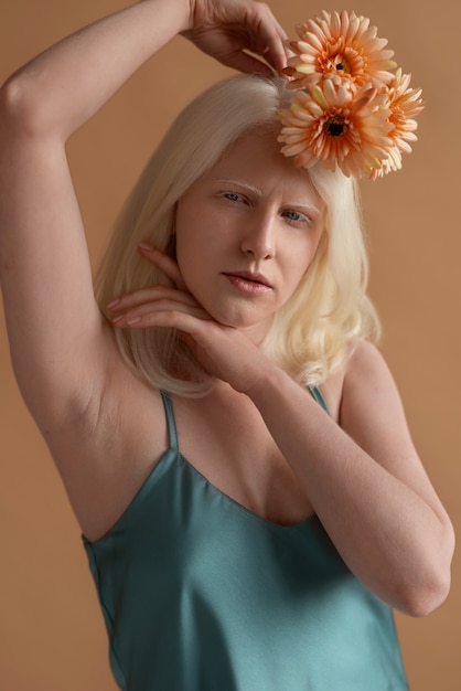 Foto gratuita vista frontal mujer con albinismo posando en estudio