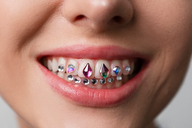 Foto gratuita vista frontal mujer posando con gemas dentales
